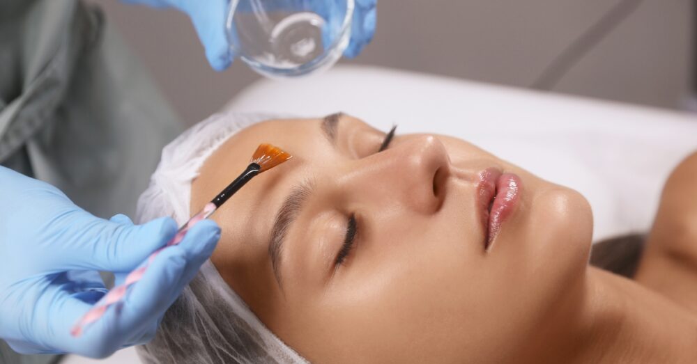 Woman lying down with eyes closed while an aesthetician applies a chemical peel solution to her forehead with a brush