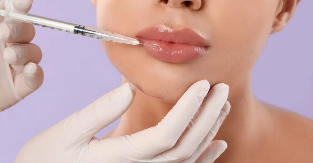 Woman receiving lip filler injections from a gloved provider